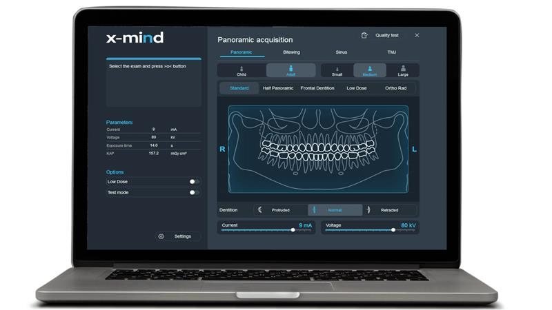 Logiciel d'acquisition panoramique X-MIND